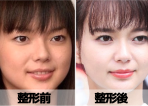 【画像5選】多部未華子の二重が不自然！顔変わりすぎや違うとの反応も！